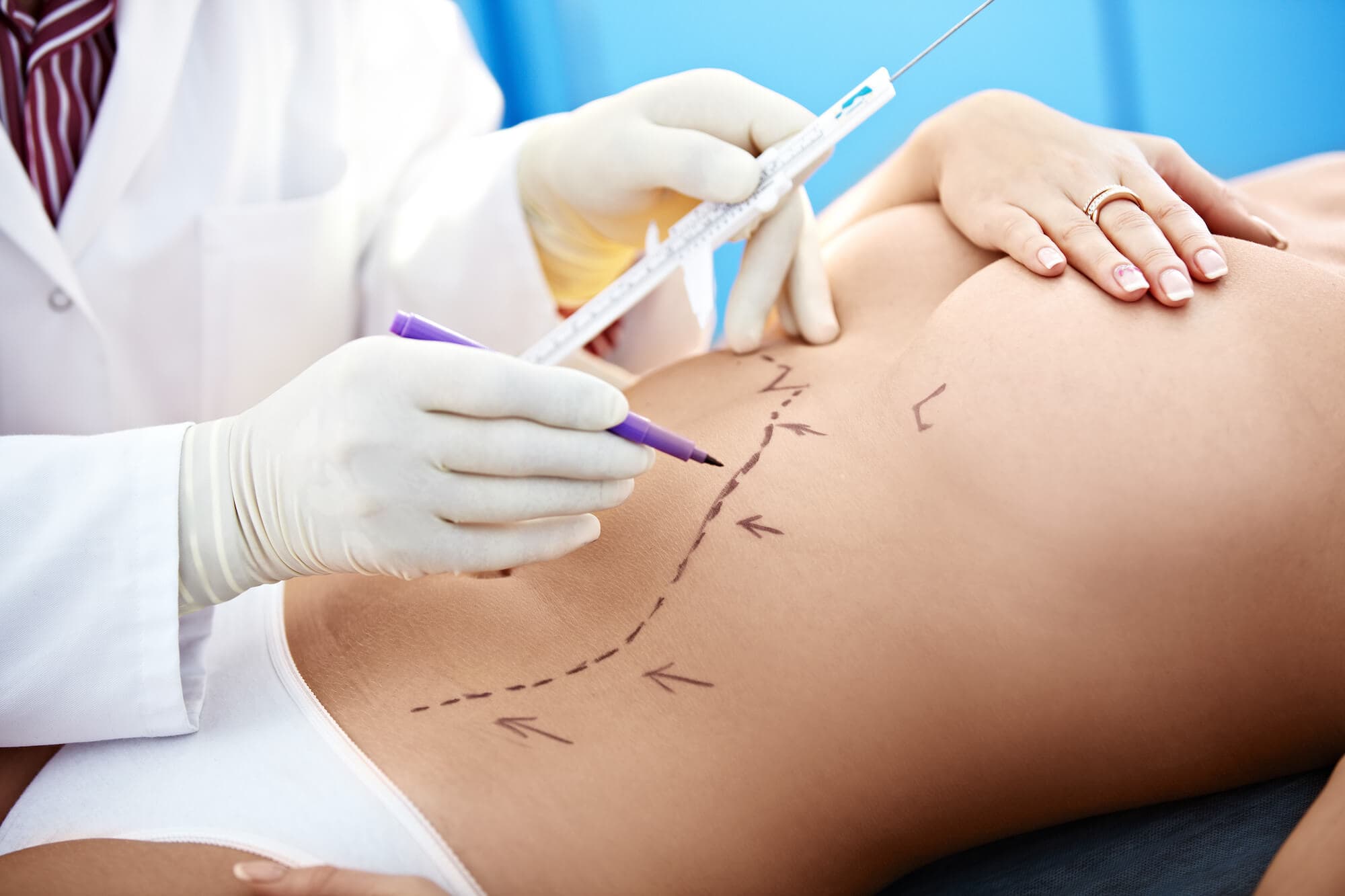 5 Tips to Make Your Plastic Surgery Marketing More Effective