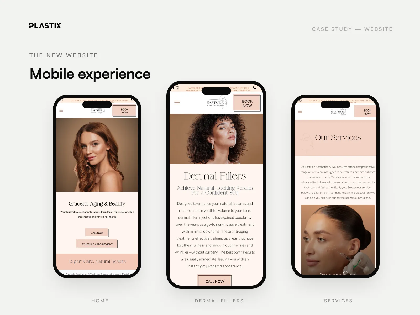 Eastside Aesthetics & Wellness website design on mobile