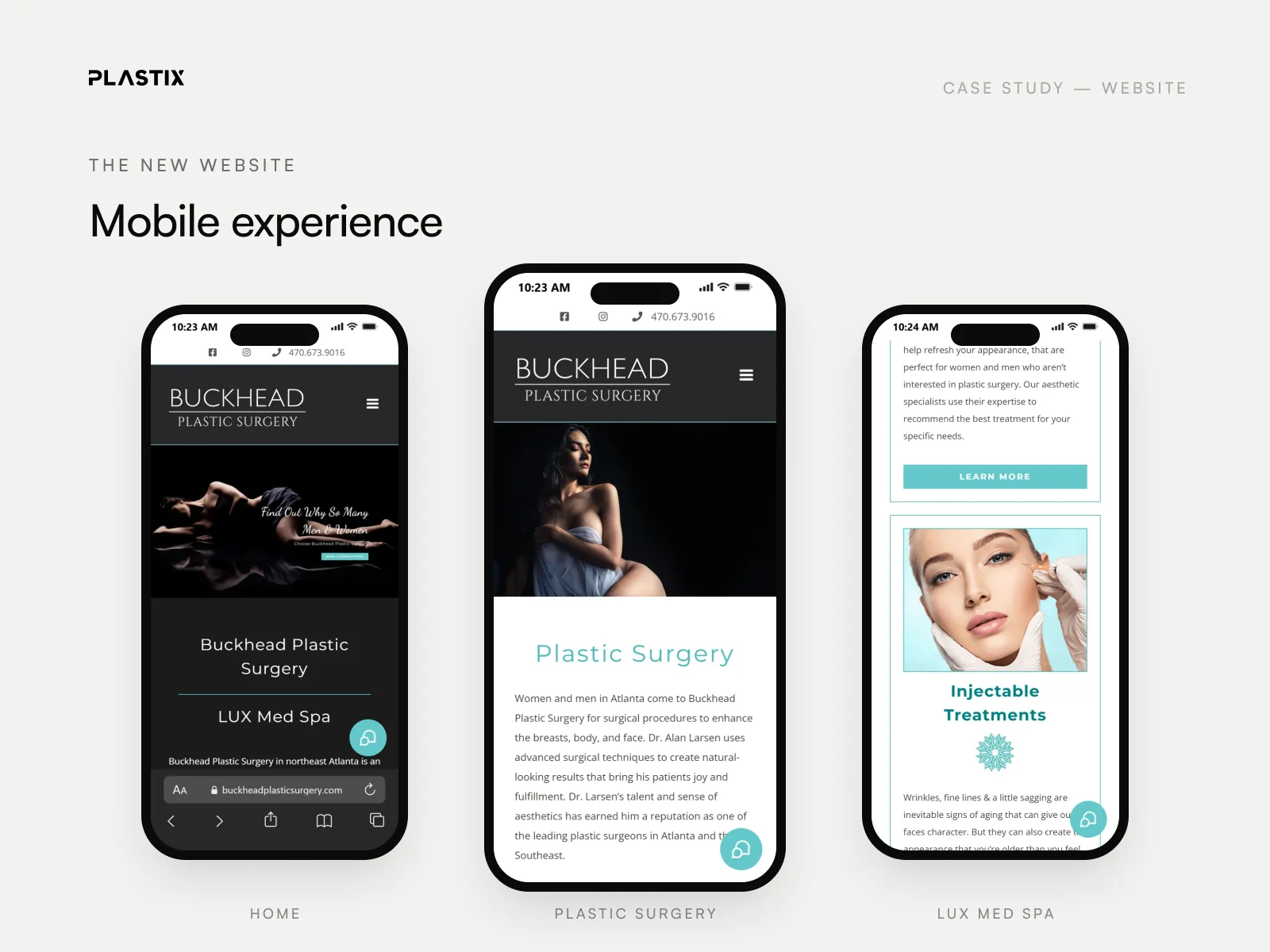 Buckhead Plastic Surgery website design on mobile